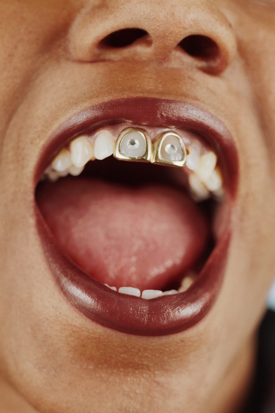 boog diameter Dom Tooth gem: lees hier alles wat je moet weten over tandjuwelen
